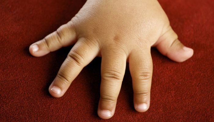 fatfingered
